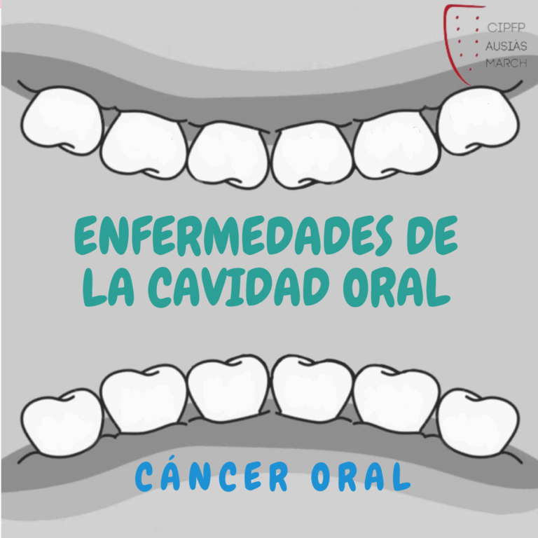 Cáncer Oral - Enfermedades de la Cavidad Bucal